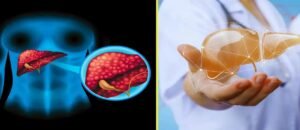 নীরব ঘাতক! জঙ্ক ফুড থেকে স্ট্রেস— এভাবেই তিলে তিলে শেষ হচ্ছে আপনার লিভার, সাবধান না হলে বিপদ!