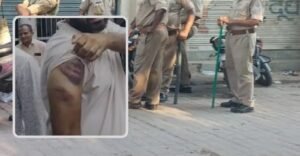 পুলিশের মারে জখম তিন যুবক: গোরখপুরে হেফাজতে নির্যাতনের অভিযোগে উত্তাল প্রশাসন