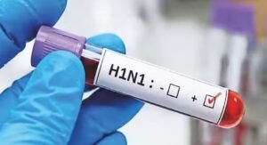 সামান্য সর্দি-কাশি ভাবছেন তো? H1N1 ভাইরাসে ফুসফুস নষ্ট হওয়ার আগে কোন ভুলগুলি আজই শুধরে নেবেন?
